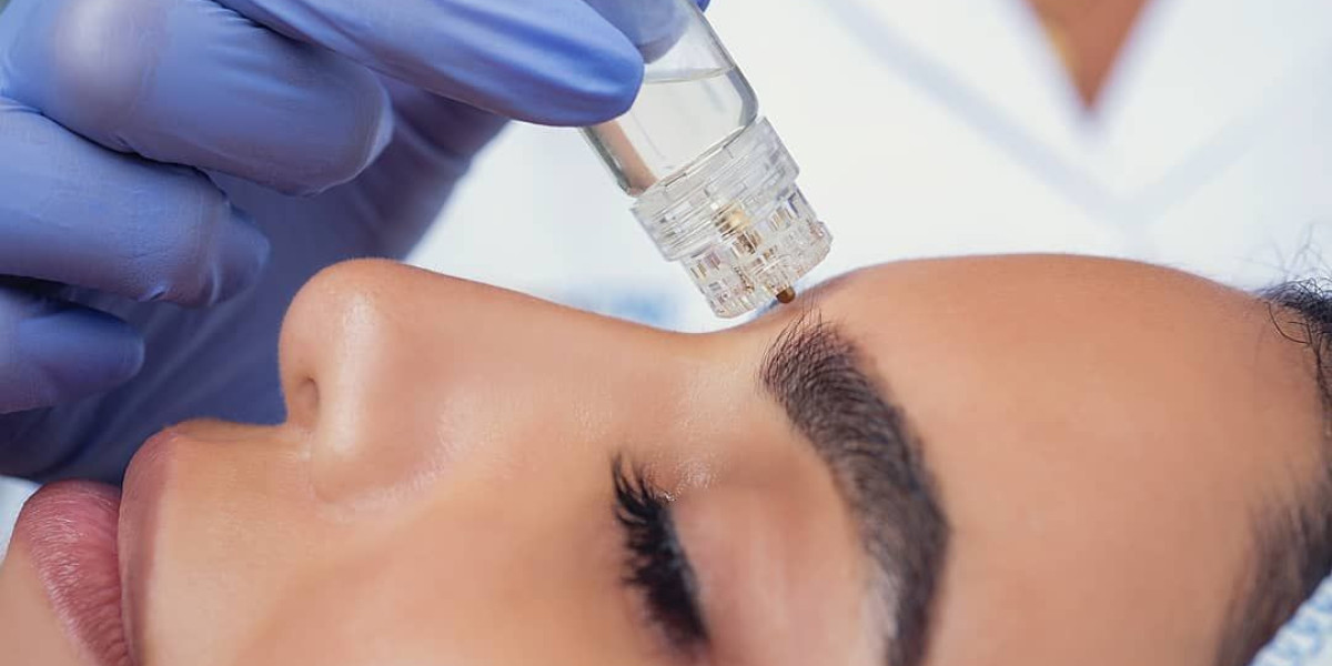 Microneedling Behandlung für strahlende Haut und moderne Hautverjüngung